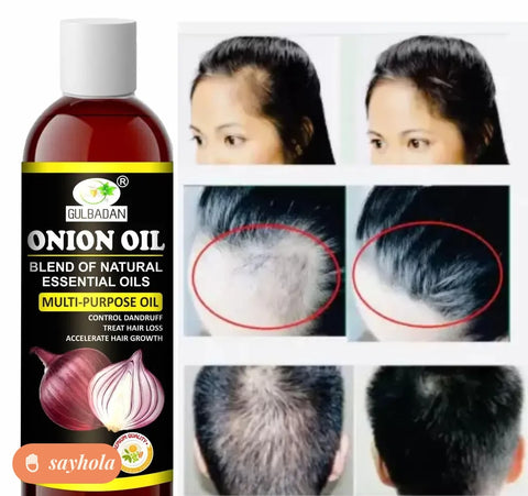 onion hair oil for hair regrowth and dandruff control